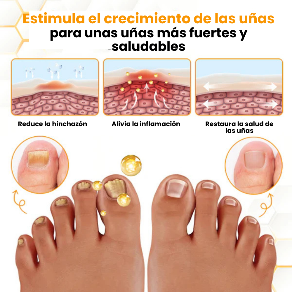 BeeVenom™- Aceite Anti-Hongos Uñas