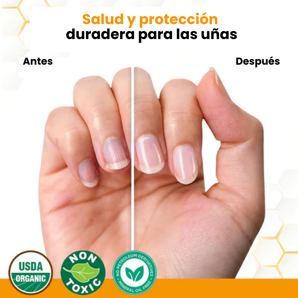 BeeVenom™- Aceite Anti-Hongos Uñas